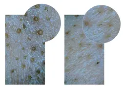 毛穴洗浄初回キャンペーン