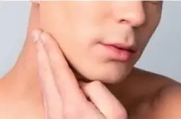 フェイス減毛
