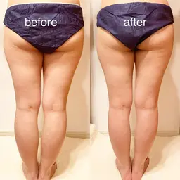 人気No1【インディバ90分】組み合わせ自由/冷え・むくみ・肩こり・お顔ケアも