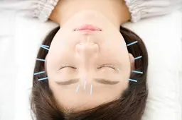 美容鍼コース