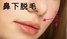 【鼻下/口周りの脱毛】◆年末年始キャンペーン価格◆1回