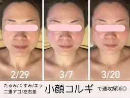 【女性限定】即効性抜群❣️小顔コルギ💆🏻‍♀️モデル様募集💛45分✨むくみスッキリ✨肩や首こりも同時に解消☺️