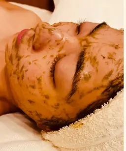 【11月限定】肌質改善•ニキビ•小顔🌿OHLハーブピーリング/剥離なし🌸むくみスッキリ《ラジオ波+小顔リフト☆70分