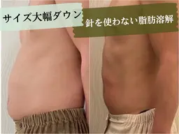 🌿2回目/3回目の方限定🌿針を使わない脂肪撃退【お身体1部位】