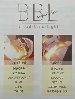 BBL(ブロード・バンド・ライト)  フェイシャル