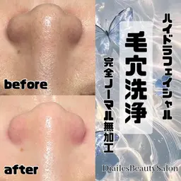 🫧全顔毛穴洗浄🫧毛穴汚れしっかり除去⏰60分