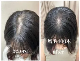 ナチュラルコース　増毛400本