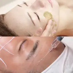 【ミニモ限定🫧肌質改善×リフトアップしたい方❤️】剥離なしハーブピーリング+溶ける糸リフトパック🫶🏻