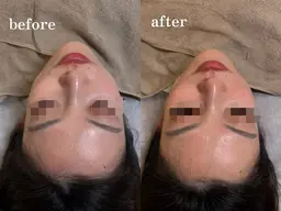 【時短コース】食いしばりほぐし&フェイスライン整えプラン🪴