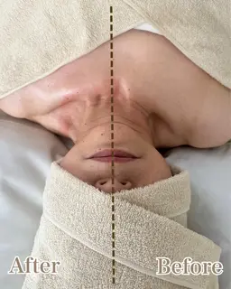 たるみ、むくみが気になる方へ★小顔トリートメント60分