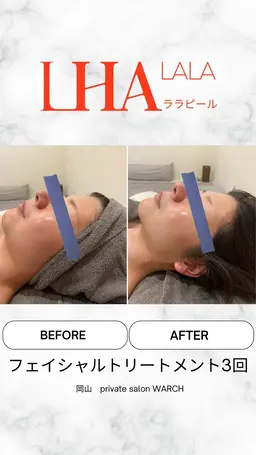 ララピール