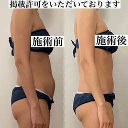 🧖‍♀️筋膜リリース ︎💕︎施術時間40分