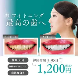7月限定✨先着10名様🦷セルフホワイトニング 2照射30分【メンズ/レディース】