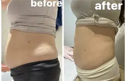 ❤️‍🔥冷却×高周波×次世代EMS×酵素付き135分通常70,600円→初回24,800