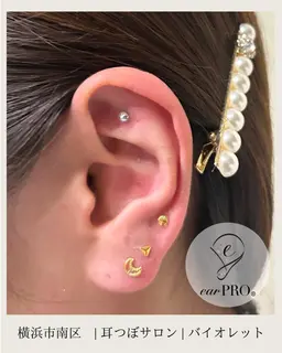 耳つぼセラピー( 耳つぼジュエリー )