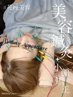 美容鍼灸
