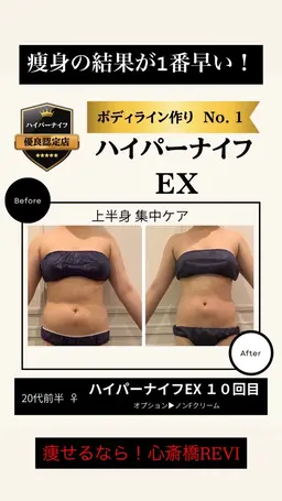 【当日予約‼️先着3名限定】半身ハイパーナイフEX🔥31,900円→9,570円‼️ 驚きの変化を体感してください✨