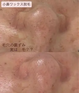 【施術モデル・ビフォーアフター撮影可の方限定】眉毛ワックス脱毛＋小鼻ワックス脱毛