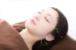 口コミ投稿にて0円❗️【スピード電気美容鍼】短時間でリフトアップ🌼