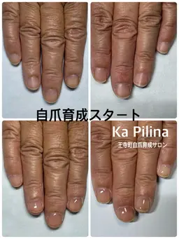 モニター限定自爪育成クリア