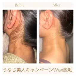 うなじ美人キャンペーン✨あなたのうなじそのまで大丈夫？意外とみられているうなじをWAX脱毛でつるっと綺麗に！