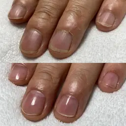 甘皮周りドライケア✨