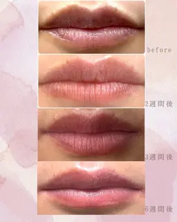 【唇のくすみケア】ローマピンクでトーンUP◎すっぴん美人に💋