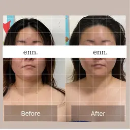 40代50代女性多数ご来店下さってます‼️ミニモ限定企画✨頭痛肩こりでお悩みの方必見！90分極上ヘッドスパ