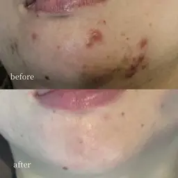 【肌管理メニューにお悩みの方はコチラ】韓国肌管理/お悩み別にご案内　¥0