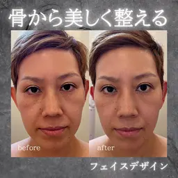 【フェイスデザイン】顔が整うソフトコルギ！痛く無い！肌も変わる特殊コルギ◎肩甲骨、肩、首にもアプローチ！SNS掲載◎の方