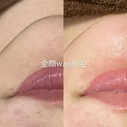【まずはお試し◎】顔ワックス脱毛×肌鎮静パック🌿口コミ必須
