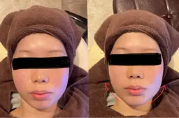 お顔スッキリメニュー✨