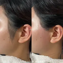 🖤BLACK FRIDAY期間限定🖤【VIO+もみあげワックス脱毛】