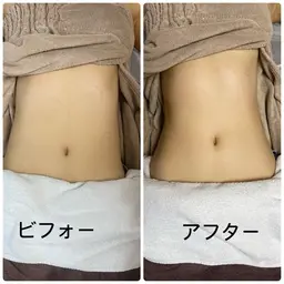 遺伝子ケア