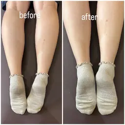 集中骨盤矯正コース✨とにかく骨盤の歪みが気になる方❗骨盤の歪みチェック付き✨