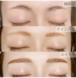 《期間限定》美眉Wax脱毛＋ティント9,180→4,400