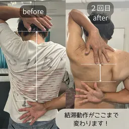 🌱通常メニュー🌱肩甲骨筋膜リリース+小顔リフトアップ/90分◎【肩こり・首こり/むくみ・食いしばり・眼精疲労】🌟