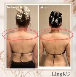 【韓国式】小顔コルギ×整体コルギ×ヘッドスパ×フェイシャルパック