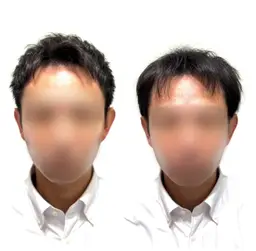 【顔出しNG】薄毛に悩む方のカット、シャンプー、ヘアセット。ホームページ、SNS等掲載用のお写真、動画の撮影。
