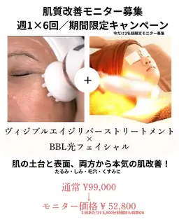 【6回モニター募集】肌質改善×たるみケア◎ヴィジブル×BBLで本気のエイジングケア✨