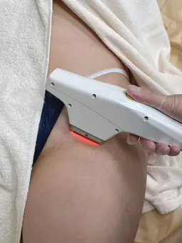 【平日限定】【IPL脱毛】 VIO脱毛