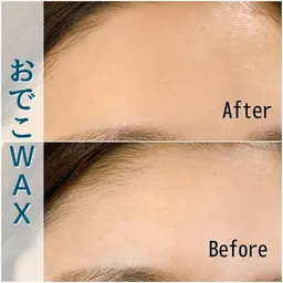 オプションメニュー●おでこWAX脱毛✨まつ毛やアイブロウとセットでお得!