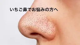 夏の肌荒れ・毛穴改善フェイシャル🌺✨
