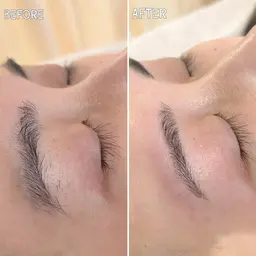 まゆ毛スタイリング&おでこワックス脱毛