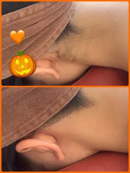 🍂秋こそ美しさを手に🍂うなじ脱毛、ポニーテールや背中美人へ！是非1度お任せ下さい✨