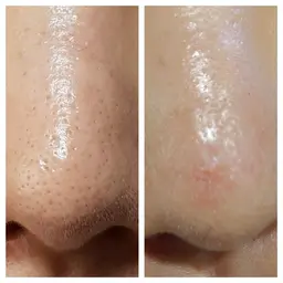 最新✨韓国🇰🇷で大人気❣️ララピール🖌️💕即効性あり💎✨️