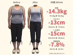 【10kg以上痩せたい方♪】セルライト除去×食事改善サポートの初回体験