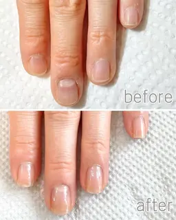 自爪育成《最強のネイルケア3ヶ月コース》モニター募集〇〇育成ネイルケア8回分/育成専用ホームケアセット込