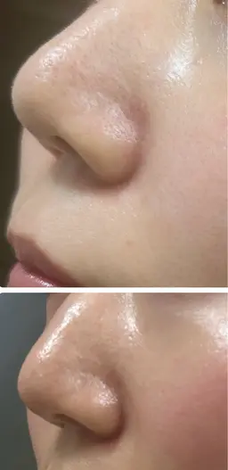 【お試し】部分ワックス　鼻