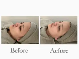 人気No1👑(60分)【小顔/むくみ/乾燥/肌荒れ】オールハンドで優しくマッサージ➕ソフトシェービングで産毛ケア